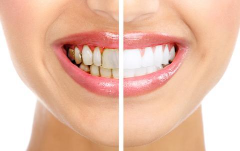 Los Ebanos Family Dentistry in Brownsville, TX | Brownsville Dentists Los Ebanos Family Dentistry in Brownsville, TX | Brownsville Dentists